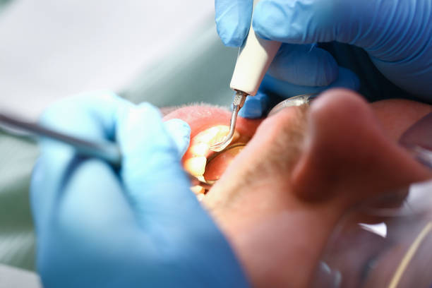 Best Emergency Dental Care for Sports Injuries in Woodland Beach, MI