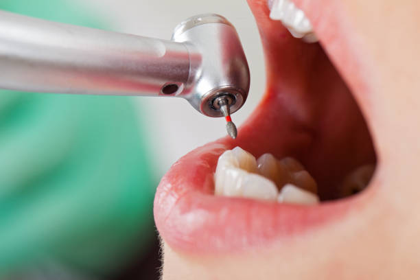 Best Emergency Denture Repair in Woodland Beach, MI